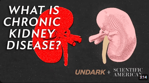 How does Dialysis Work?